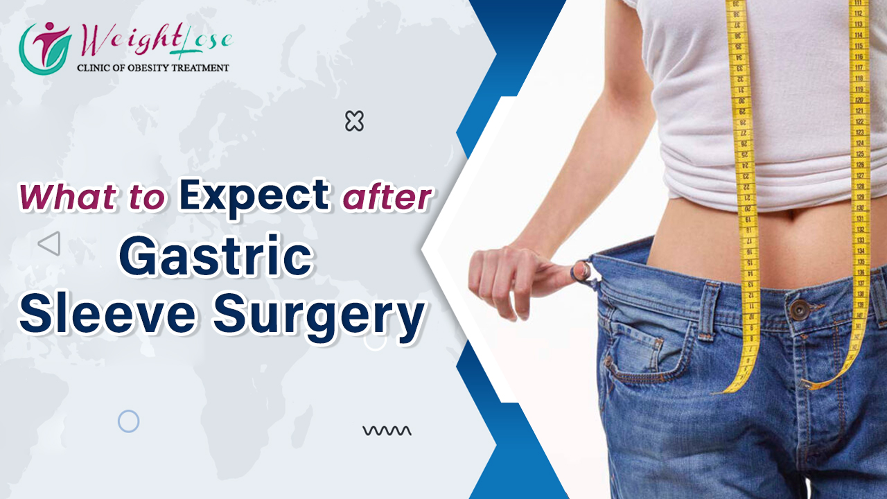 What to Expect After Gastric Sleeve Surgery?
